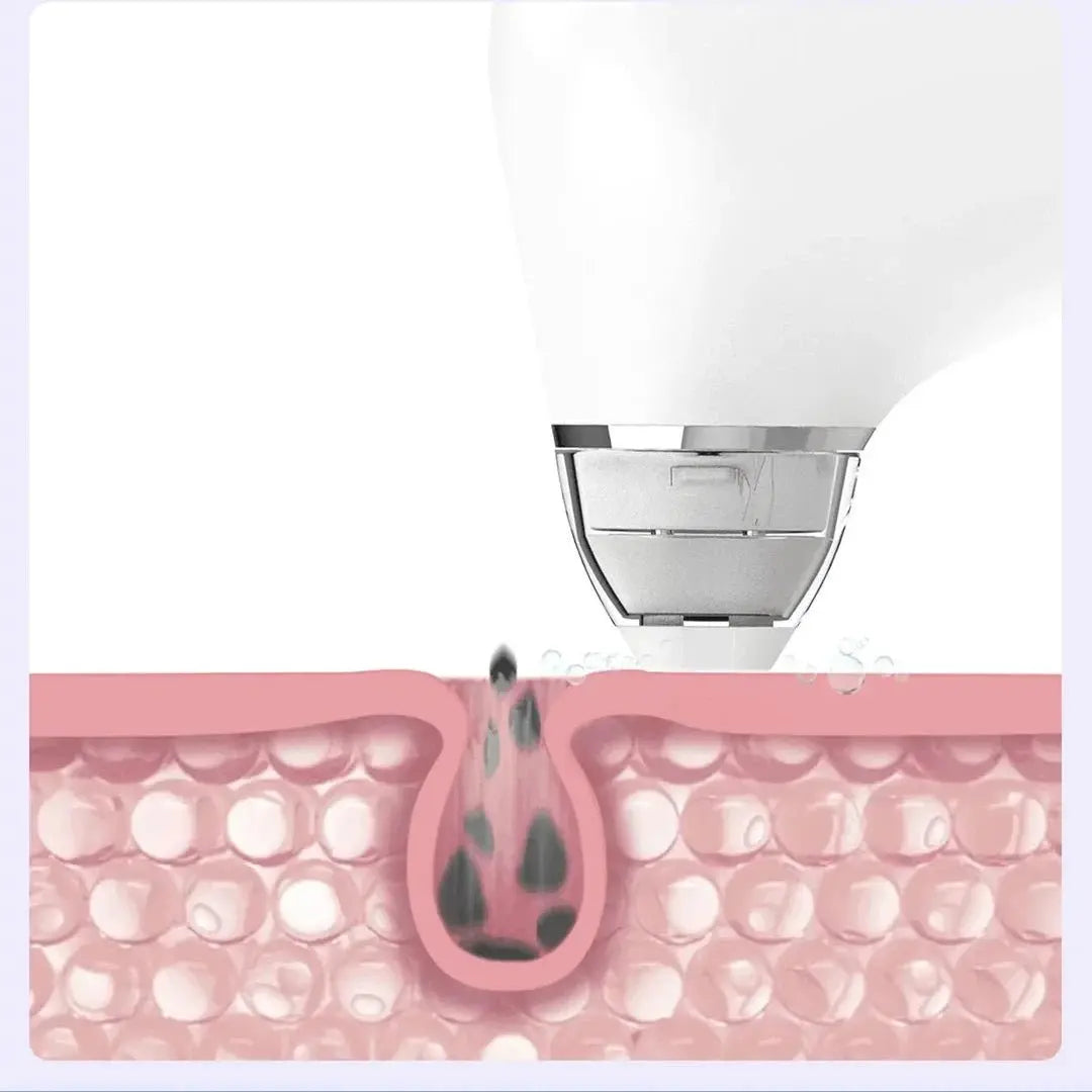 PoreVac Elite Skin Cleanser - Orsham